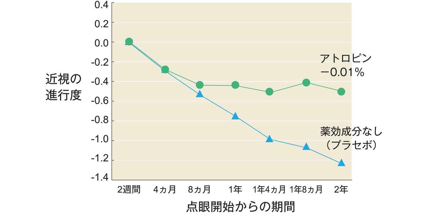 オルソケラトロジーレンズは・・・・